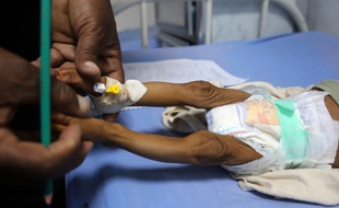 Un bébé pris en charge dans un hôpital au Yémen.