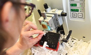 Une technicienne de laboratoire chargée d'analyser les biopsies des patients (image d'illustration).