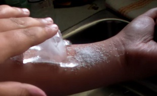 «Le ice and salt challenge» est le nouveau défi à la mode chez les jeunes.