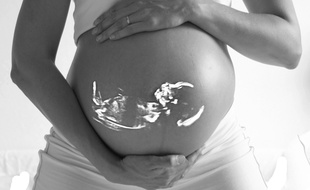 Illustration d'une femme enceinte et d'une échographie.
