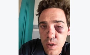 Capture d'écran de la photo publiée sur le compte Facebook d'Alexandre, violemment agressé par des taxis.