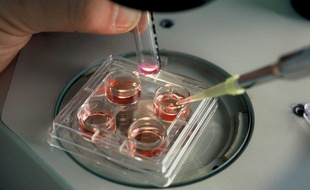 Mise en contact des spermatozoïdes et des ovocytes lors d'une fécondation in vitro.