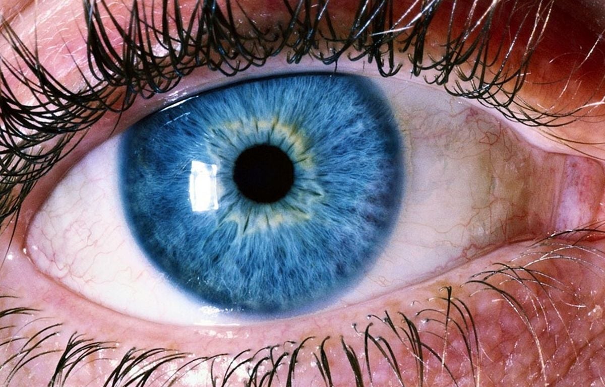 Oui, vous pouvez changer définitivement la couleur de vos yeux, mais ce n'est pas sans risque