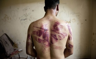 Un Syrien torturé par les forces de sécurité, sur une photo du 23 août 2012, à Alep.
