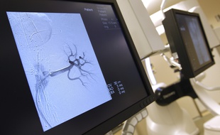 La salle hybride cardiovasculaire robotisée de l'hôpital cardiologique du CHRU de Lille (Archives).