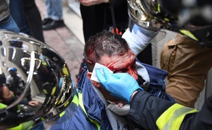 Ce pompier volontaire, manifestant blessé à Bordeaux lors de la mobilisation des gilets jaunes le 12 janvier dernier, a été plongé depuis dans un coma artificiel.