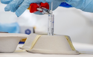 Des tests pour le coronavirus. (illustration)