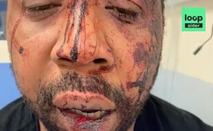 Un producteur de musique a été passé à tabac par trois policiers, dans le 17e arrondissement de Paris
