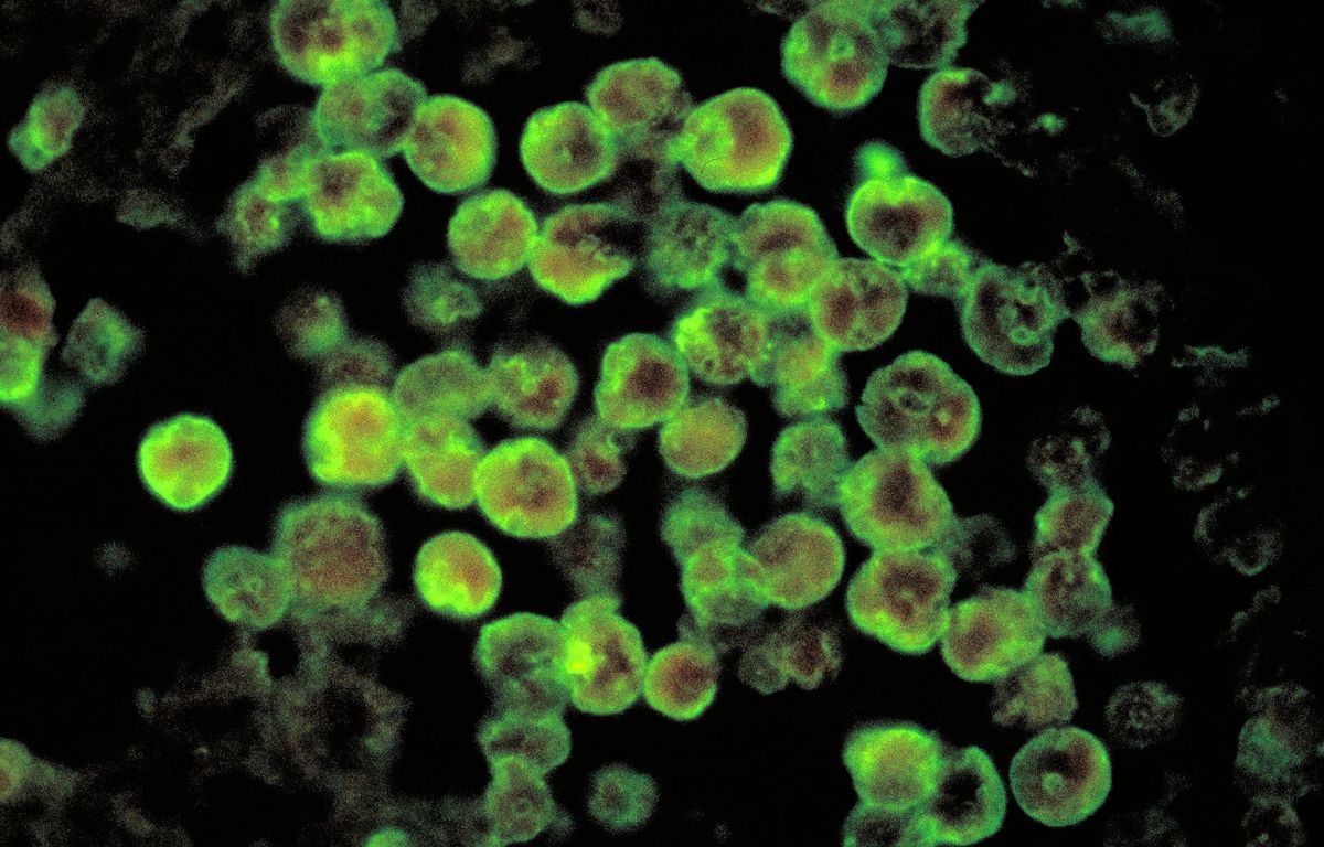 Inde : C’est quoi cette amibe « mangeuse de cerveau » qui provoque de plus en plus de décès image
