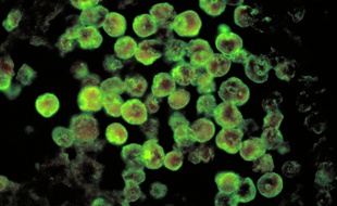 L’amibe «naegleria fowleri» provoque une rare infection des méninges.