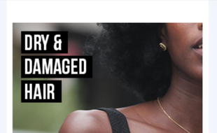 Une chaîne de pharmacies a provoqué une vague d'indignation en affichant sur son site Web des images décrivant les cheveux des Noirs