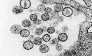 L'hantavirus, vu au microscope.