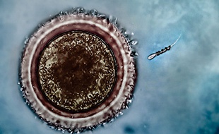 Créé par des chercheurs allemands, le mini robot "Spermbot" s’enroule autour de la queue des spermatozoïdes et accélère le trajet vers l’œuf.