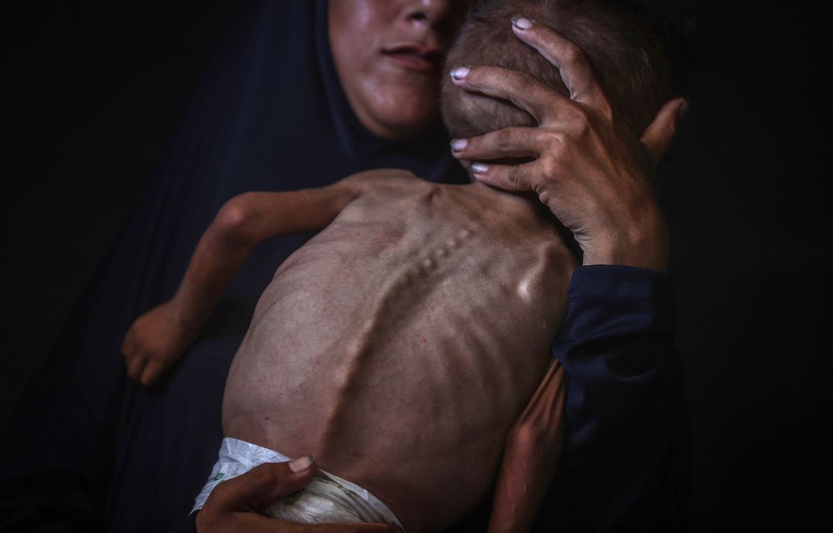 Gaza : Des photos d'enfants du Yémen utilisées pour illustrer la famine ? C'est faux