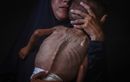 Des photos d’enfants du Yémen utilisées pour illustrer la famine à Gaza ? C'est faux !