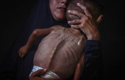 Des photos d’enfants du Yémen utilisées pour illustrer la famine à Gaza ?