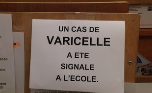 Affichette annonçant un cas de varicelle dans une école strasbourgeoise. (Photo archives)