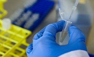 Les services de renseignements cherchent encore à déterminer d'où vient l'épidémie.