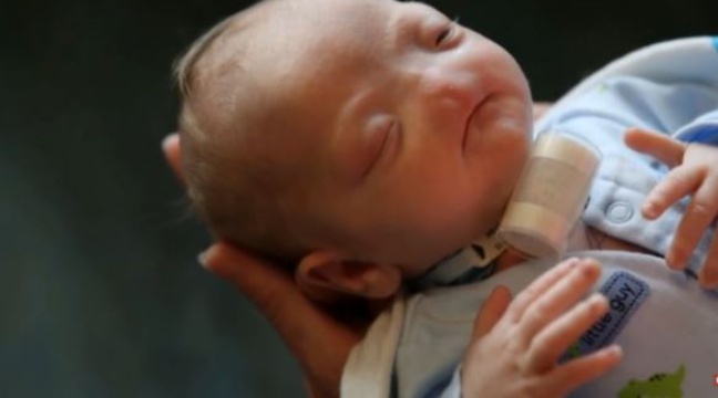 Video Facebook Admet Une Erreur Apres Avoir Supprime La Photo D Un Bebe Sans Nez