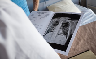 Lors d'une visite d'un patient post-Covid au sein du service de pneumologie du Pr Alain Didier, au CHU de Toulouse.