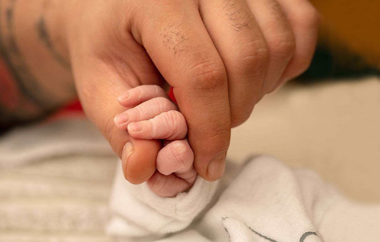 En France, un bébé est né avec 26 doigts, aucun pouce au niveau des mains, et un pied à la place du genou. (Illustration)