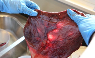 Illustration d'un placenta.
