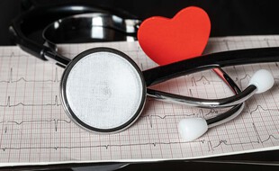 Illustration d'un électrocardiograme. L'insuffisance cardiaque, quand le coeur est fragilisé, se manifeste par une grande fatigue, un essoufflement et une prise de poids brutale.