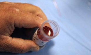 Ovules prélevés sur une patiente au bloc opératoire en 2010 à Paris.