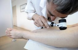 Les dermatologues alertent sur les dérives du dépistage du cancer par IA