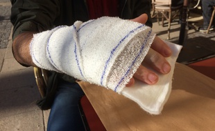 Marien, 27 ans, a une double fracture à la main droite après un tir de lanceur de balle de défense par un CRS.