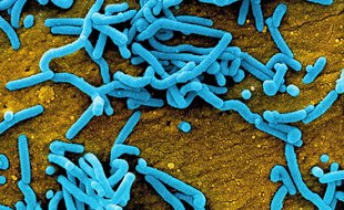 Micrographie électronique à balayage colorisée de particules du virus Marburg (bleu - fausses couleurs) bourgeonnant à la surface de cellules infectées (orange - fausses couleurs)