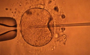 Illustration d'une micro-injection par pipette d'un spermatozoide dans un ovocyte