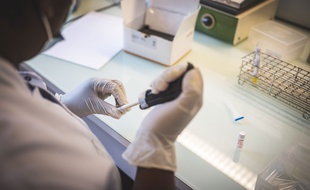 La Haute Autorité de santé (HAS) dévoile ce mardi une synthèse de la littérature scientifique portant sur l'immunité développée par les malades après avoir contracté le Covid-19.