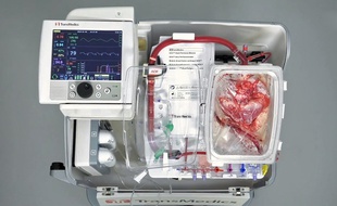Cette machine permet de laisser l'organe «travailler».