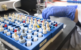 Un scientifique avec des échantillons de tests, en Belgique, le 11 mars.