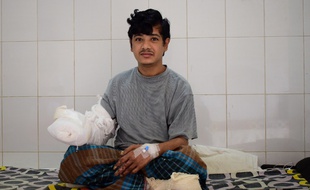 Abul Bajandar, connu comme "l'homme-arbre", a été opéré à Dacca (Bangladesh)