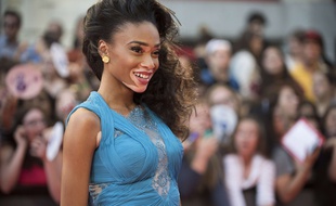 La mannequin Winnie Harlow est atteinte de vitiligo.