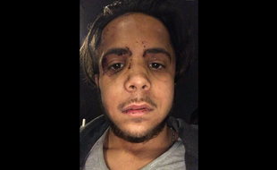Kerim affirme avoir été victime de violences policières dimanche soir.