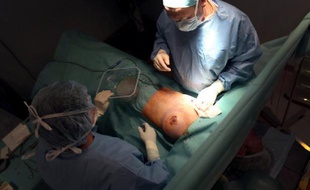 Les prothèses mammaires de la société française Poly Implant Prothèse (PIP), au coeur d'un vaste scandale en France, étaient surtout vendues à l'étranger, notamment en Grande-Bretagne, où 250 femmes ont porté plainte, et en Amérique du Sud où elles ont été interdites dès 2010.