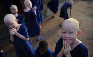 Des enfants albinos sont recueillis dans une école en Tanzanie, le 25 janvier 2009