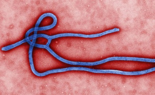 Le virus Ebola vu au microscope électronique.