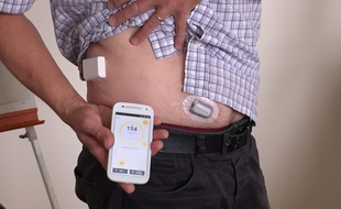 Lyon, le 26 juin 2017. Six patients de l'hôpital Lyon Sud testent depuis un mois le pancréas artificiel, une technologie destinée à améliorer le quotidien de diabétiques de type 1.