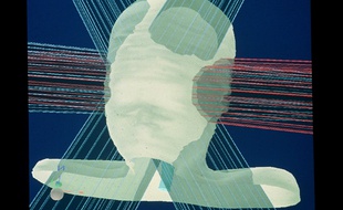 La radiothérapie fait partie de l'arsenal pour lutter contre le cancer du cerveau. Illustration.